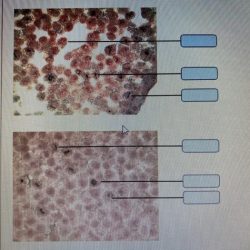 Cell membranes transport